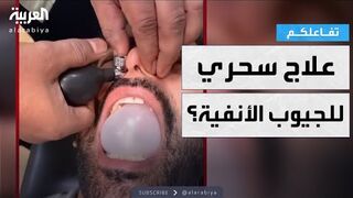 تفاعلكم  ترند تنظيف الجيوب الأنفية .. علاج سحري