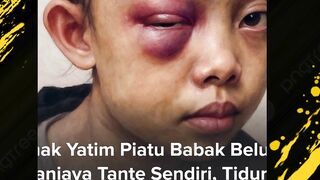 MIRIS! Ponakan sendiri dianaiya, ga ada otak