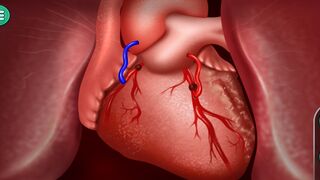 Heart Surgery Medical Game: The Ultimate Training Tool for Surgeons || Heart Surgery Medical Game
