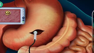 Stomach Surgery Medical Game: The Perfect Way to Learn Surgery Skills || Get a Taste of Real Stomach Surgery with Medical Game