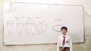 Types of teeth
