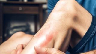 Right way to itch