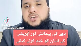 Surgery k nisnat khatm krny k liay