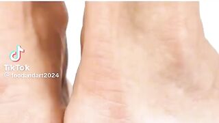 Crack heels