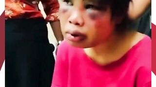 Seorang ART asal Sumba disiksa hingga babak belur di Batam.