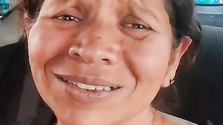 Botox stock solucion