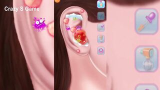 Asmr surgery animation video ASMR surgery animation video 2022 | Asmr Video 2023