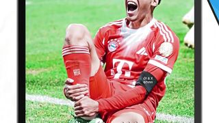 Cedera Jamal musiala saat PSG kalahkan Bayern Munchen