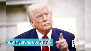 Donald Trump Diagnosed With Chronic Venous Insufficiency