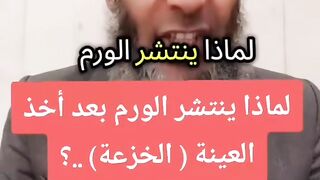 احذروا من خزعة الموت