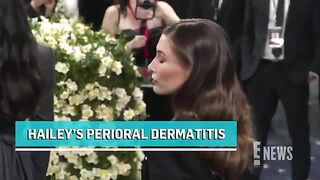 Hailey Bieber Shares Look at Her Perioral Dermatitis Flare Up.