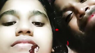 আমদর দষট
