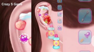 Asmr surgery animation video ASMR surgery animation video 2022 | Asmr Video 2022 p-2