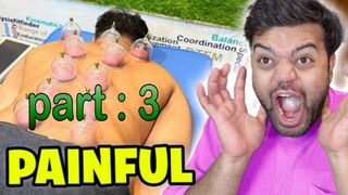 Last part. .  .  .  Getting Hijama for the First Time  Dont Watch This Video While Eating X