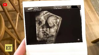 Jessa Duggar Gives Birth to Baby