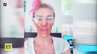Brandi Glanville Gets CHEMICAL BURN on Face Amid Health Battle