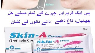 Skin A Cream  Price In Pakistan 03003778222