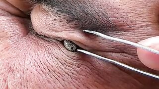 tips for eyes