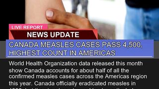 Canada Measles Cases Pass Highest Count in