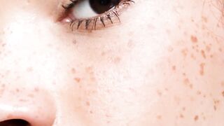 Skin cancer short overview