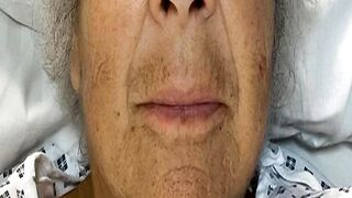 Miriam Margolyes Wants to Be Put Down If Health