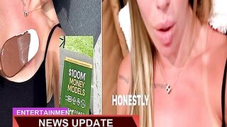 Holly Hagan Displays Her Sunburnt Chest as She Spe