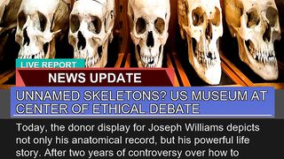 Unnamed Skeletons US Museum at Center of Ethical