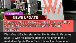 Aussie Rules Player Latest Found with Concussionl
