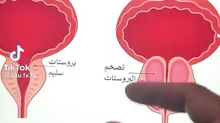 والله العلي العظيم أن لي ١٠ سنوات في مجال الاعشاب ما عمري خبرت أحد عن هذا العلاج