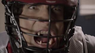 Teen-Wolf S01E03
