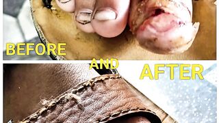 Before and after
