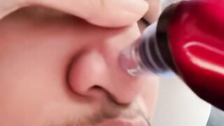 surprise during treatment