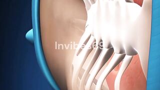 How Doctors Fix a Sunken Chest?