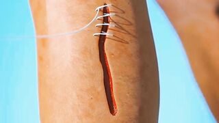 How Stitches Work  magic thrille thrillont