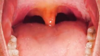 What Is The Purpose Of Your Uvula?  thrillont thrille corgi