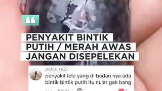 Penyakit BINTIK PUTIHMERAHBegini cara mengobatinya