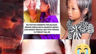 Anak kls 2 SD ini ketika pulang dari sekolahnya tiba-tiba keadaannya seperti itu