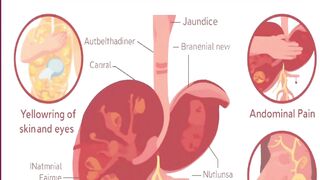 Liver Diseases Series