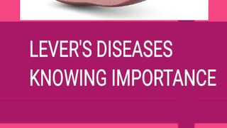 Liver disease must know