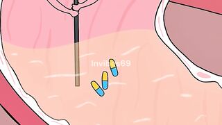 What Actually Causes Antibiotic Resistance?