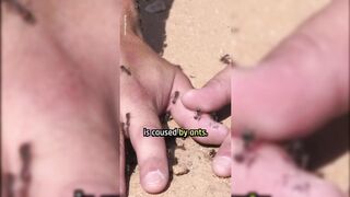 The Bullet Ant  The Worlds Most Painful Insect Sting Experience