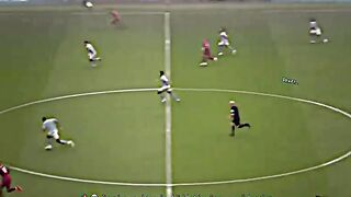what mean MCI VS LIV