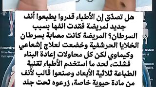 زراعة انف من الذراع سبحان الله