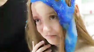 Classmates slimed her because of her birthmark