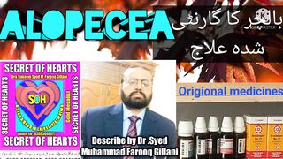 How to get rid of Alopecia