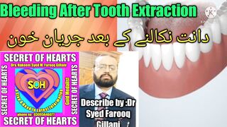 Bleeding after tooth extraction