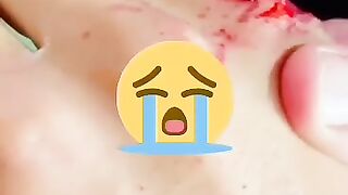 broken Heart ????