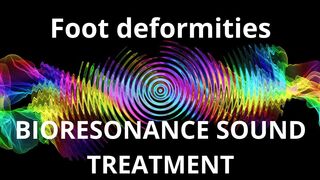 Foot deformities  Sound therapy session