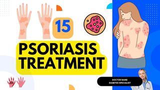 15 Psoriasis treatment- 15 Effective Psoriasis Treatment Options