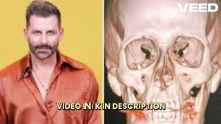 [Clip] henri castelli foi agredido henri castelli foi agredido em 2020